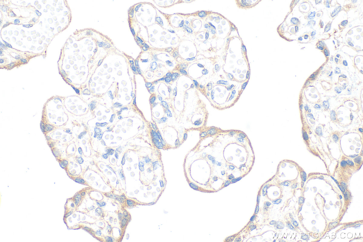 IHC staining of human placenta using 15091-1-AP