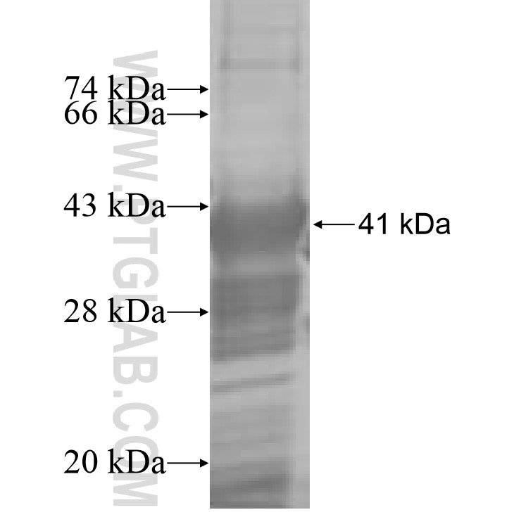 ANTXR1 fusion protein Ag8519 SDS-PAGE ANTXR1 fusion protein Ag8519 SDS-PAGE