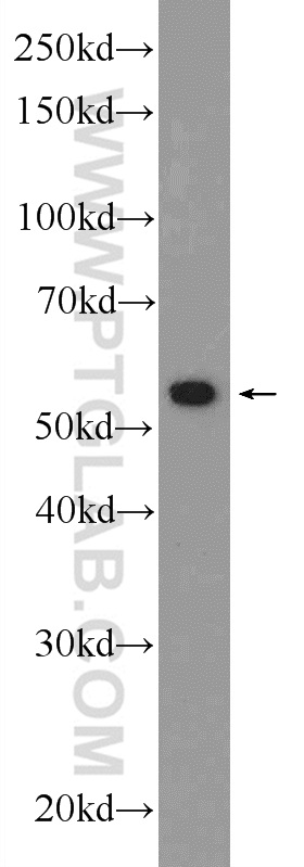 WB analysis of HEK-293 using 16723-1-AP