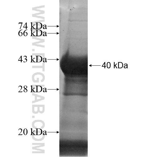 ANUBL1 fusion protein Ag11546 SDS-PAGE ANUBL1 fusion protein Ag11546 SDS-PAGE