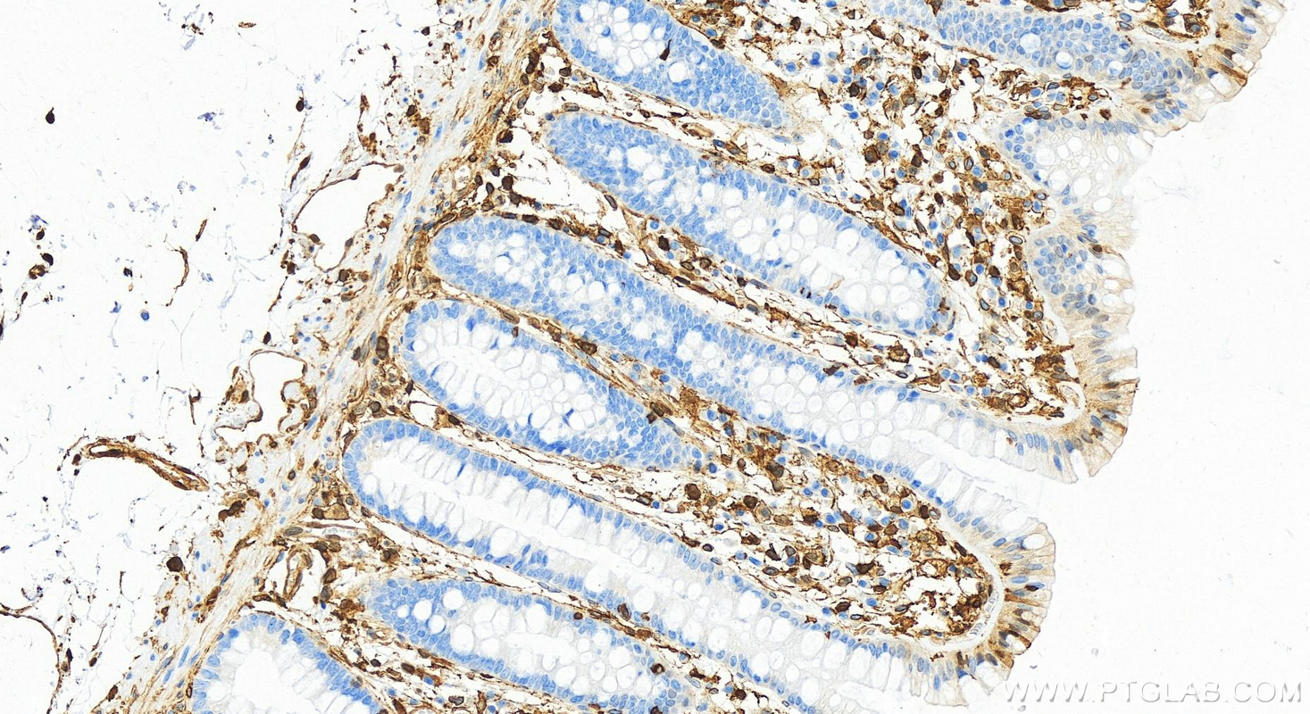 IHC staining of human colon using 21990-1-AP