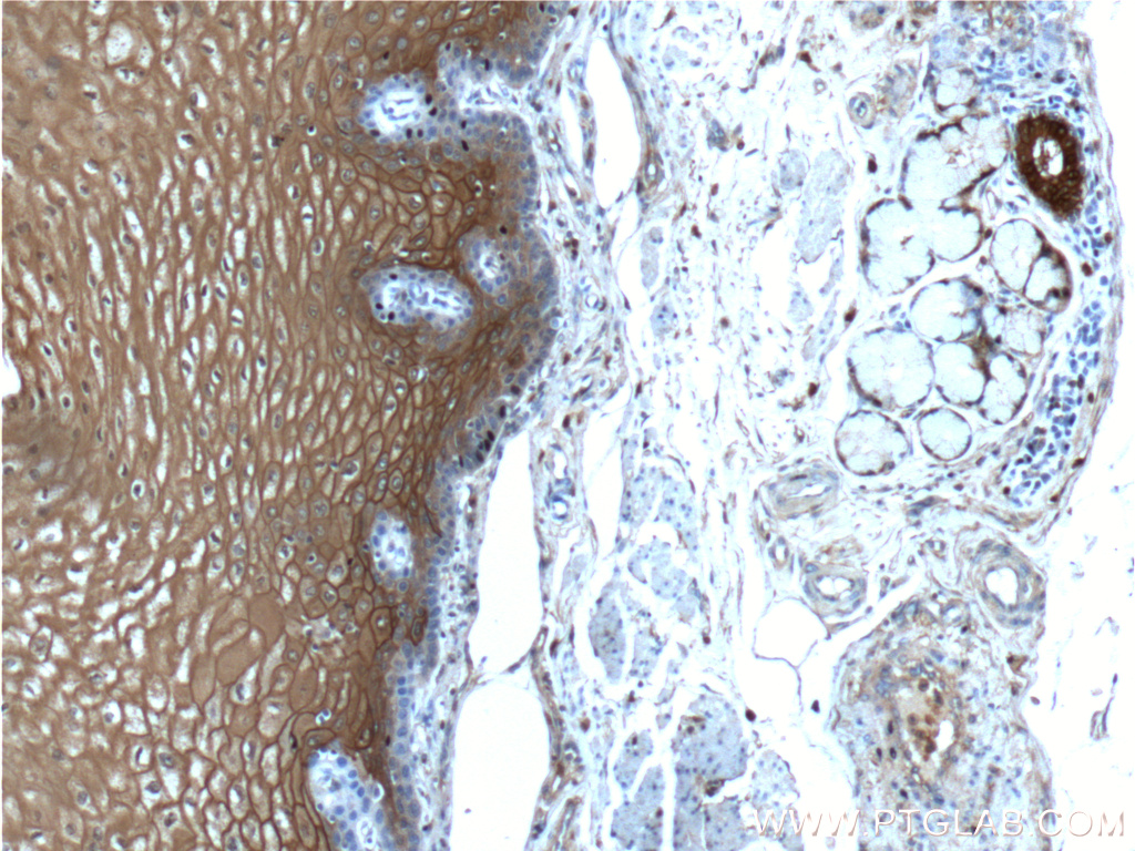 IHC staining of human oesophagus using 21990-1-AP