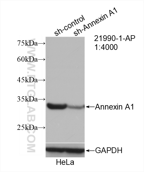 WB analysis of HeLa using 21990-1-AP