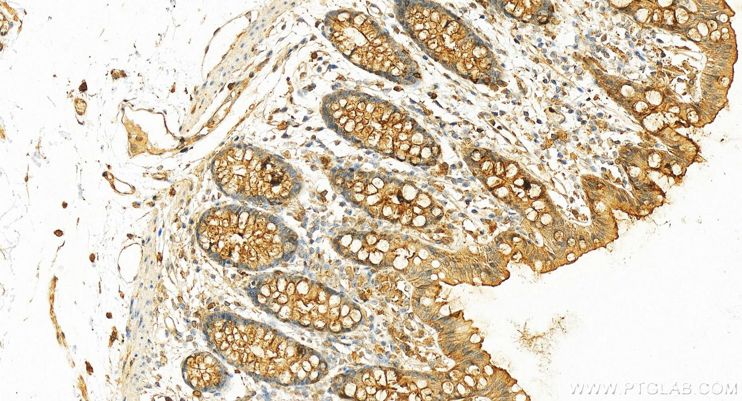 IHC staining of human colon using 55018-1-AP
