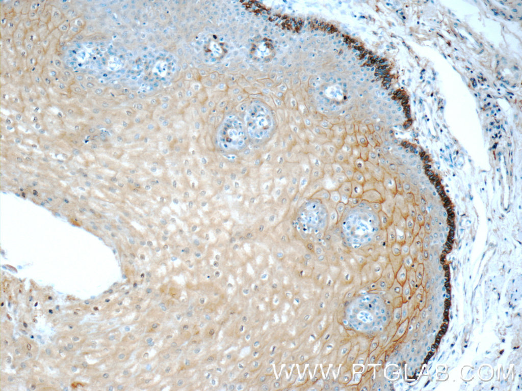 IHC staining of human oesophagus using 55018-1-AP