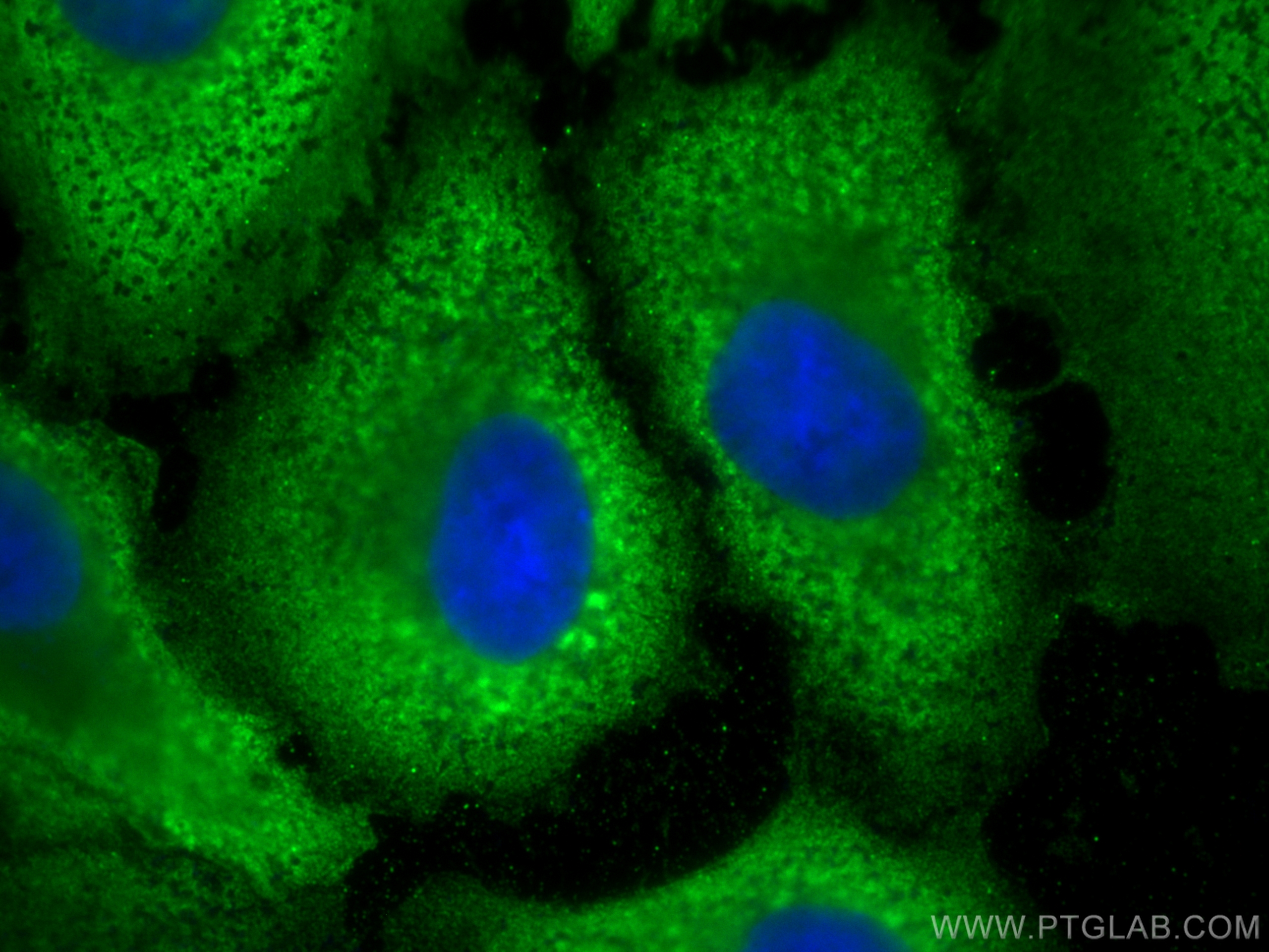 IF Staining of A549 using 66344-1-Ig