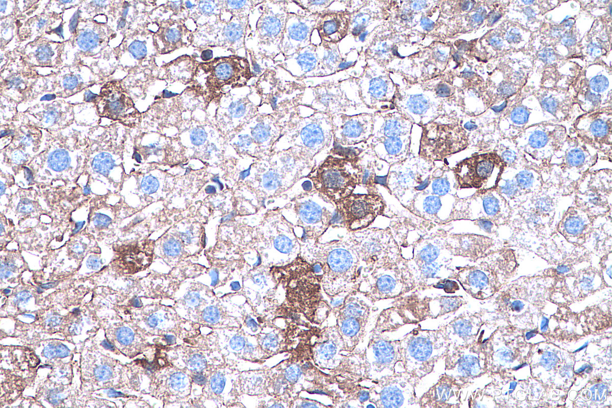 IHC staining of mouse liver using 66344-1-Ig