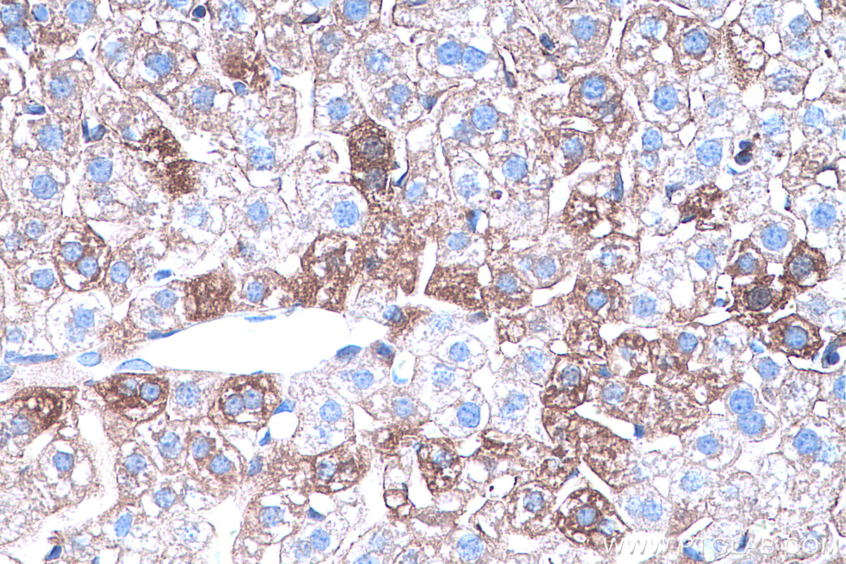 IHC staining of mouse liver using 66344-1-Ig