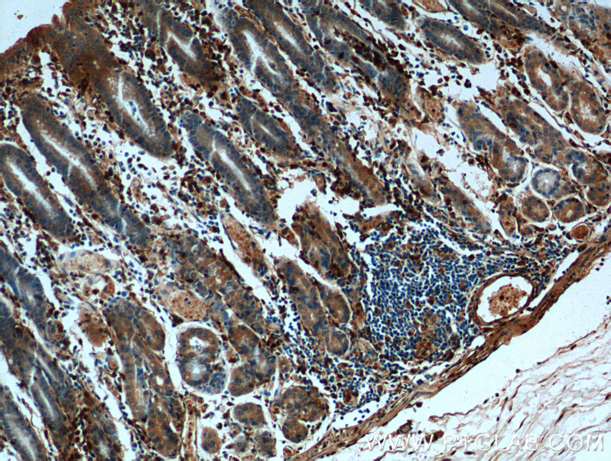 IHC staining of human stomach using 66344-1-Ig