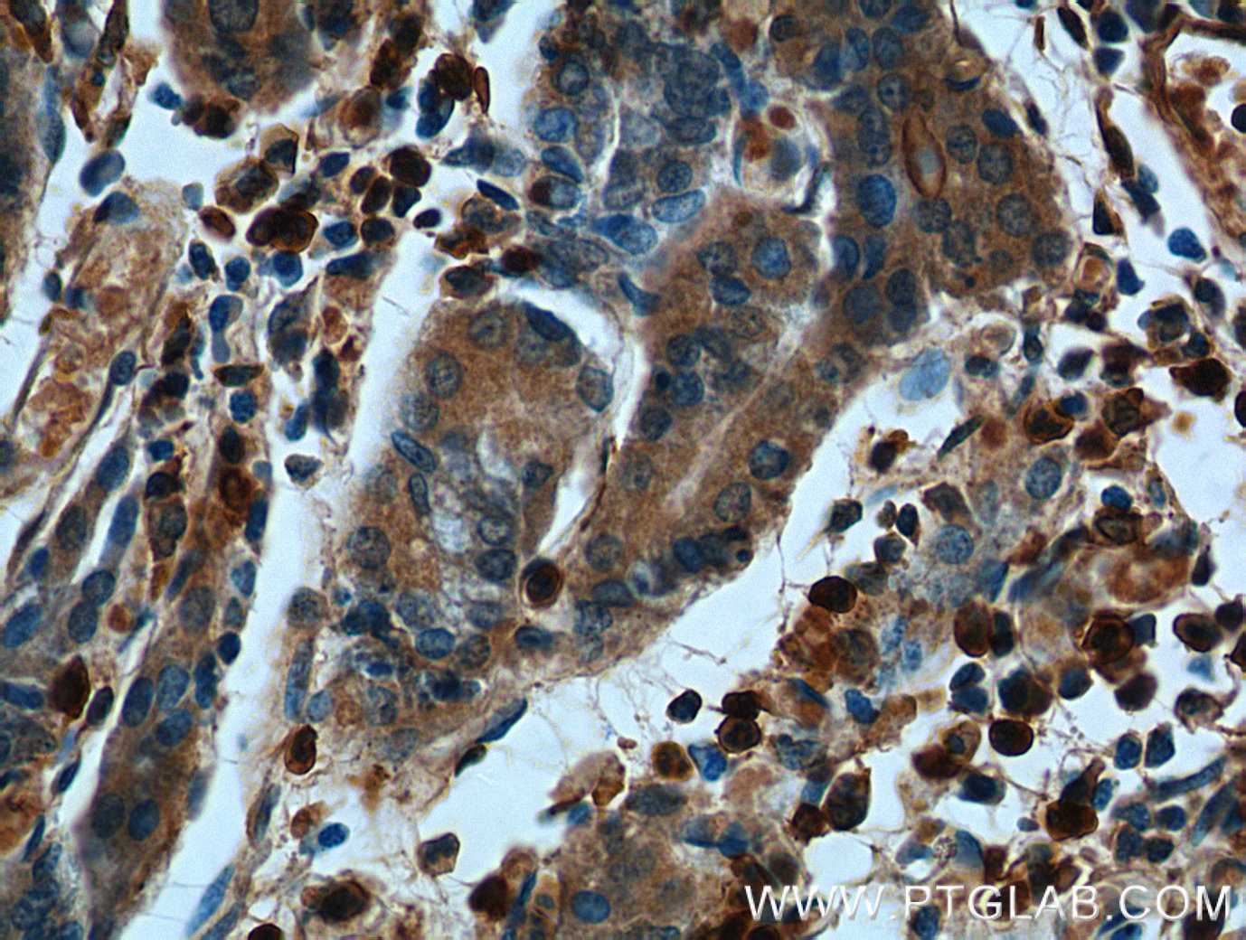 IHC staining of human stomach using 66344-1-Ig