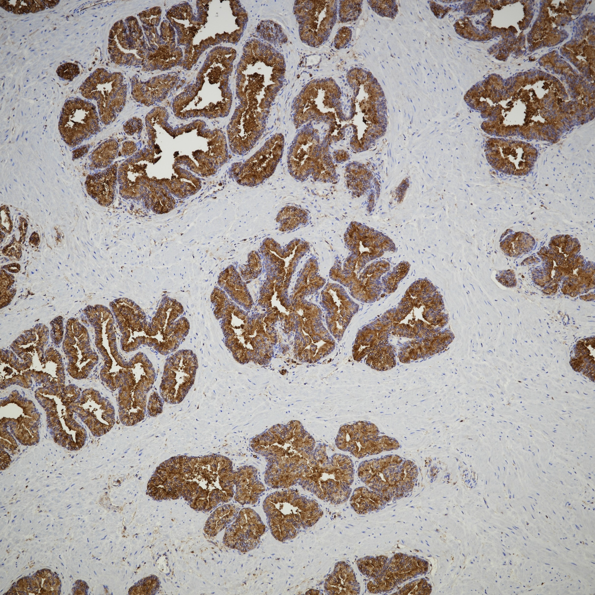 IHC staining of human prostate using 66344-1-Ig IHC staining of human prostate using 66344-1-Ig