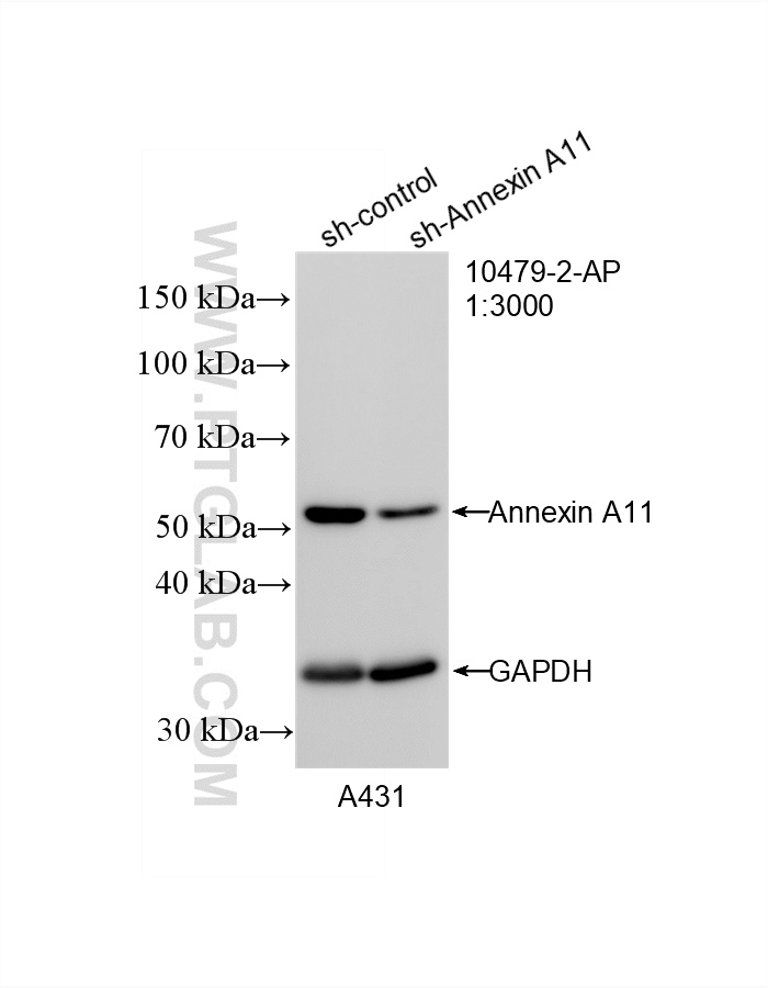 WB result of Annexin A11 antibody (10479-2-AP; 1:3000; incubated at room temperature for 1.5 hours) with sh-Control and sh-Annexin A11 transfected A431 cells. WB analysis of A431 using 10479-2-AP