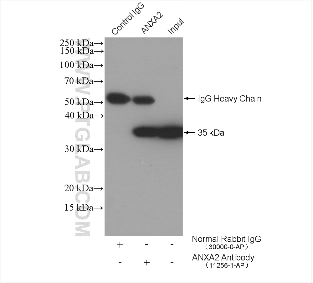 IP experiment of HeLa using 11256-1-AP