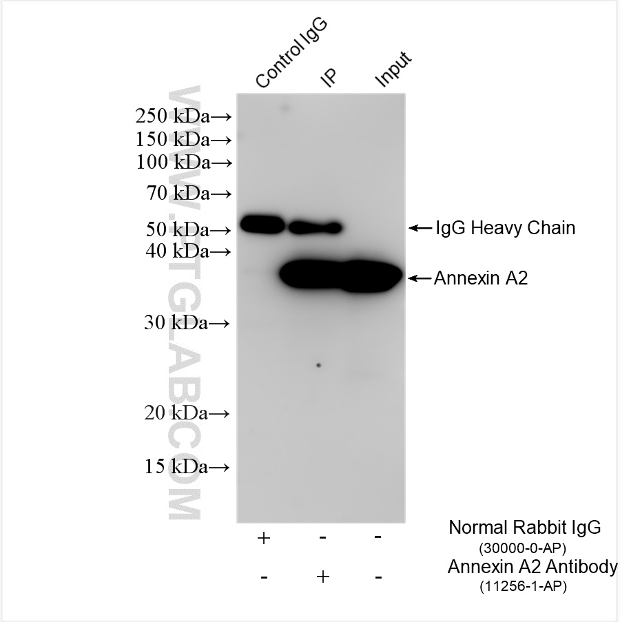 IP experiment of HeLa using 11256-1-AP
