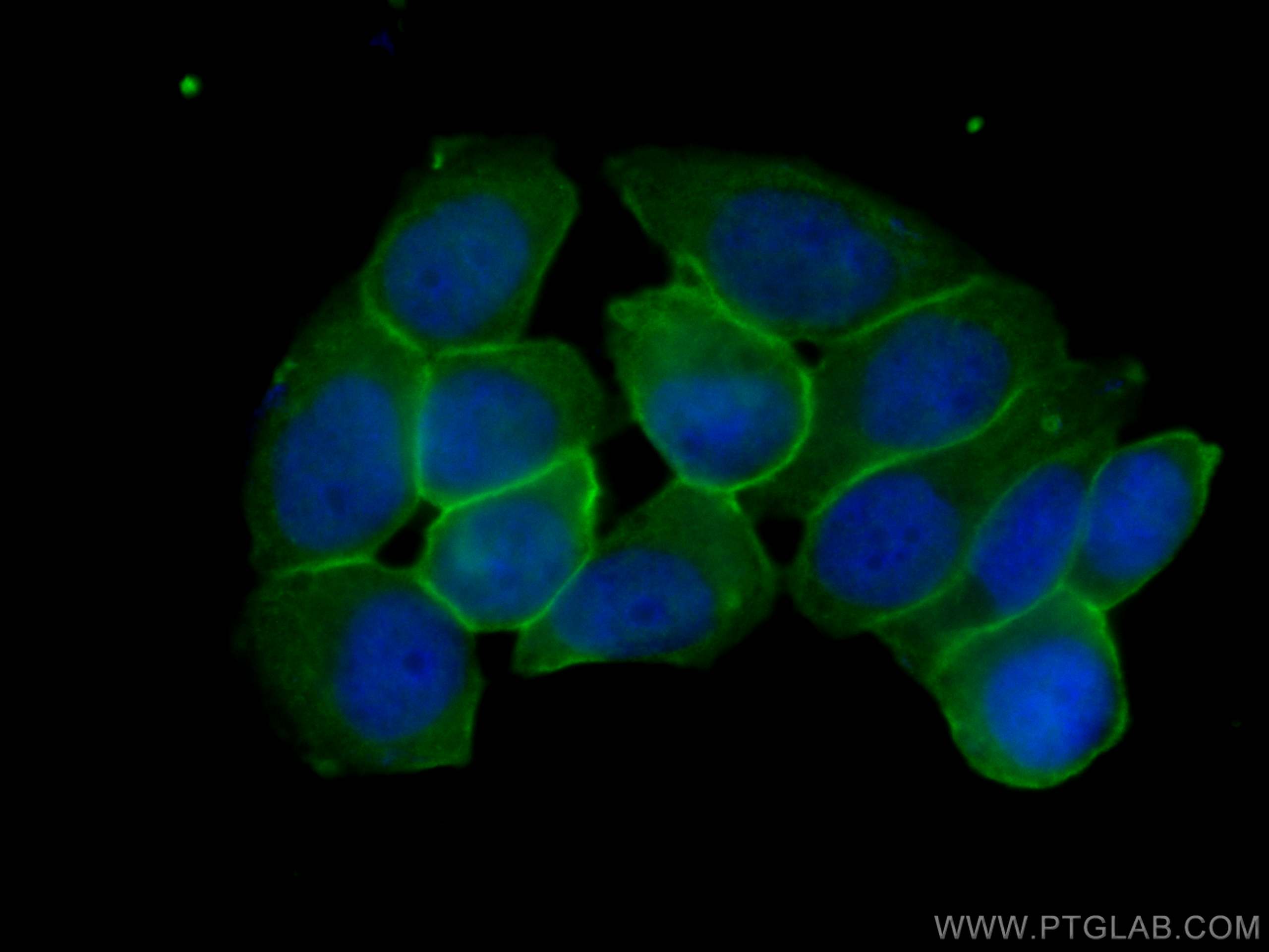 IF Staining of T-47D using 66035-1-Ig