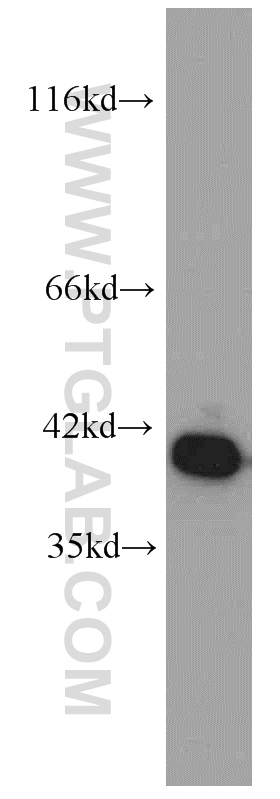 Annexin A2 Monoclonal antibody