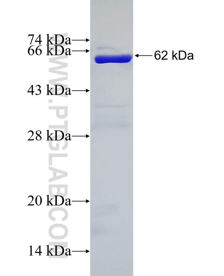ANXA3 fusion protein Ag2381 SDS-PAGE