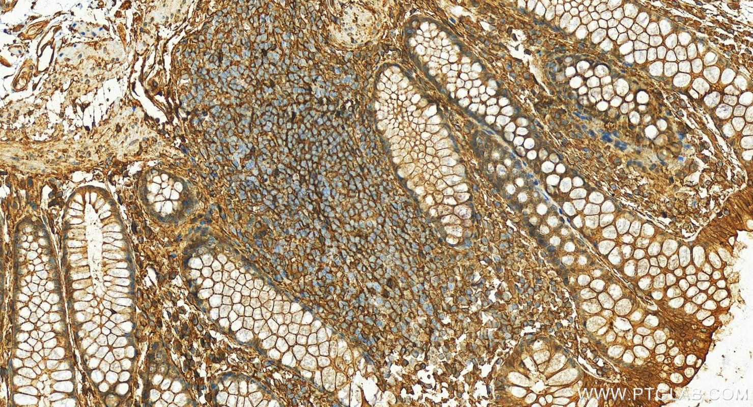 IHC staining of human colon using 10087-1-AP