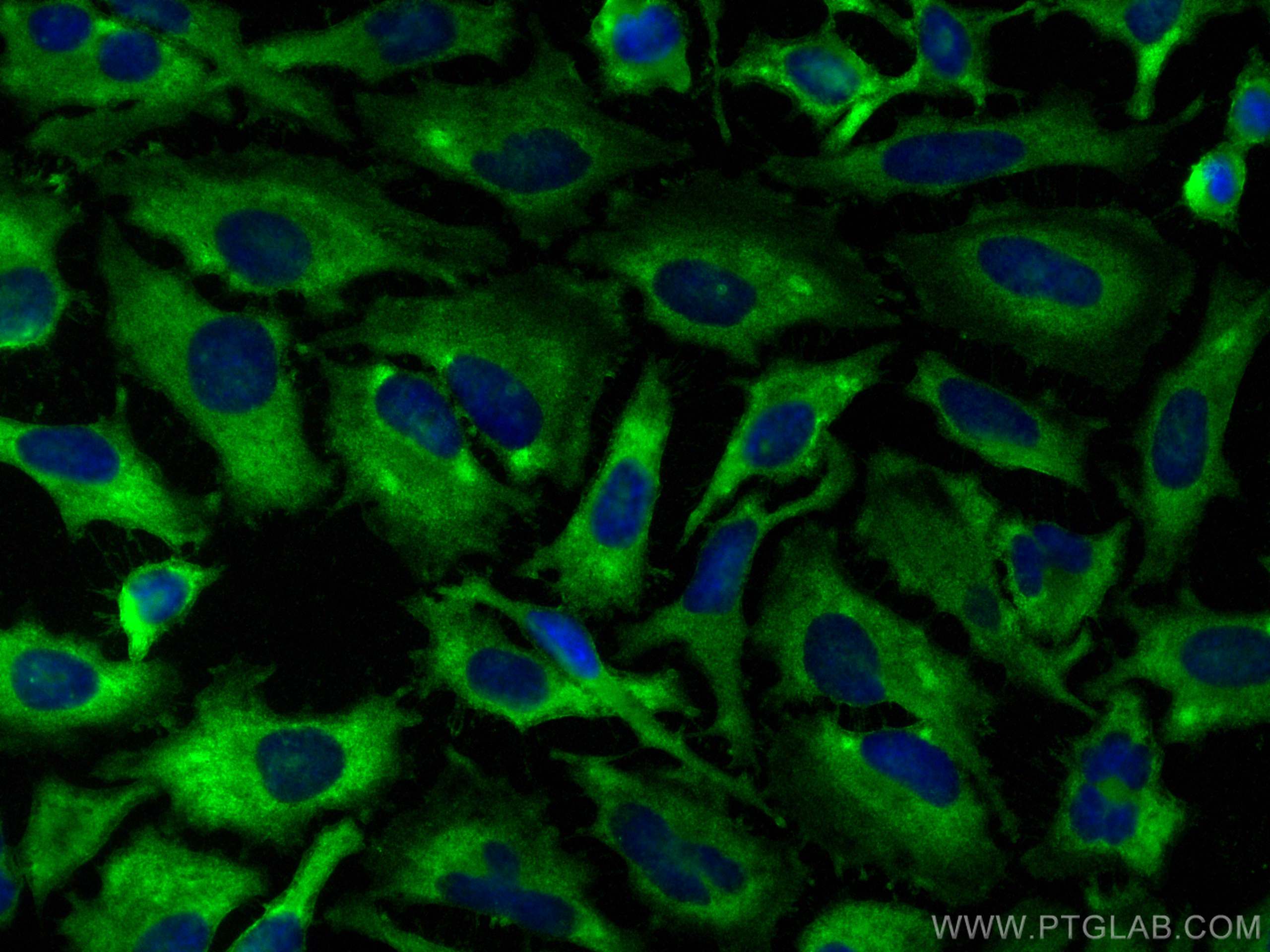 IF Staining of HeLa using 11060-1-AP