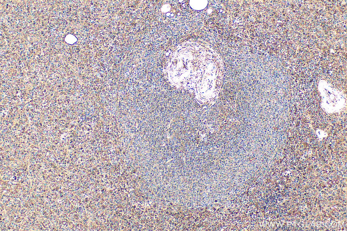 IHC staining of human spleen using 11060-1-AP