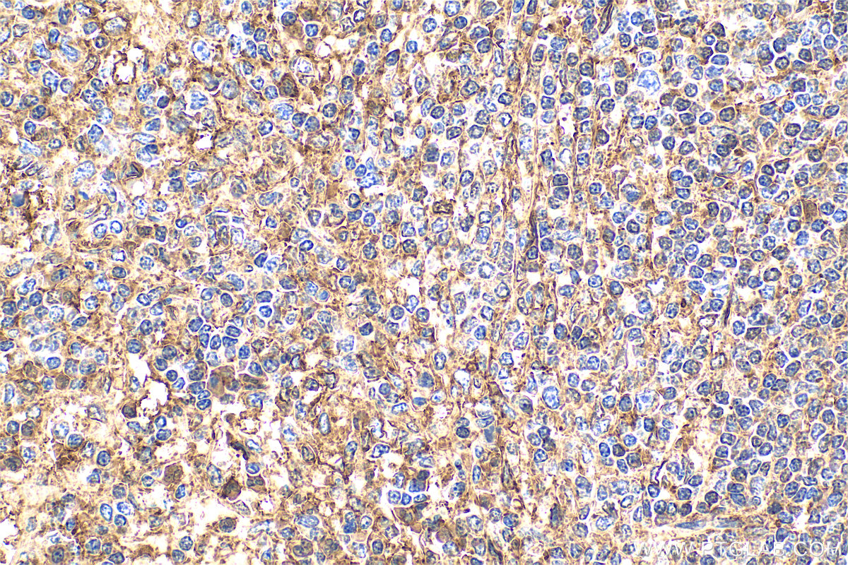 IHC staining of human spleen using 11060-1-AP