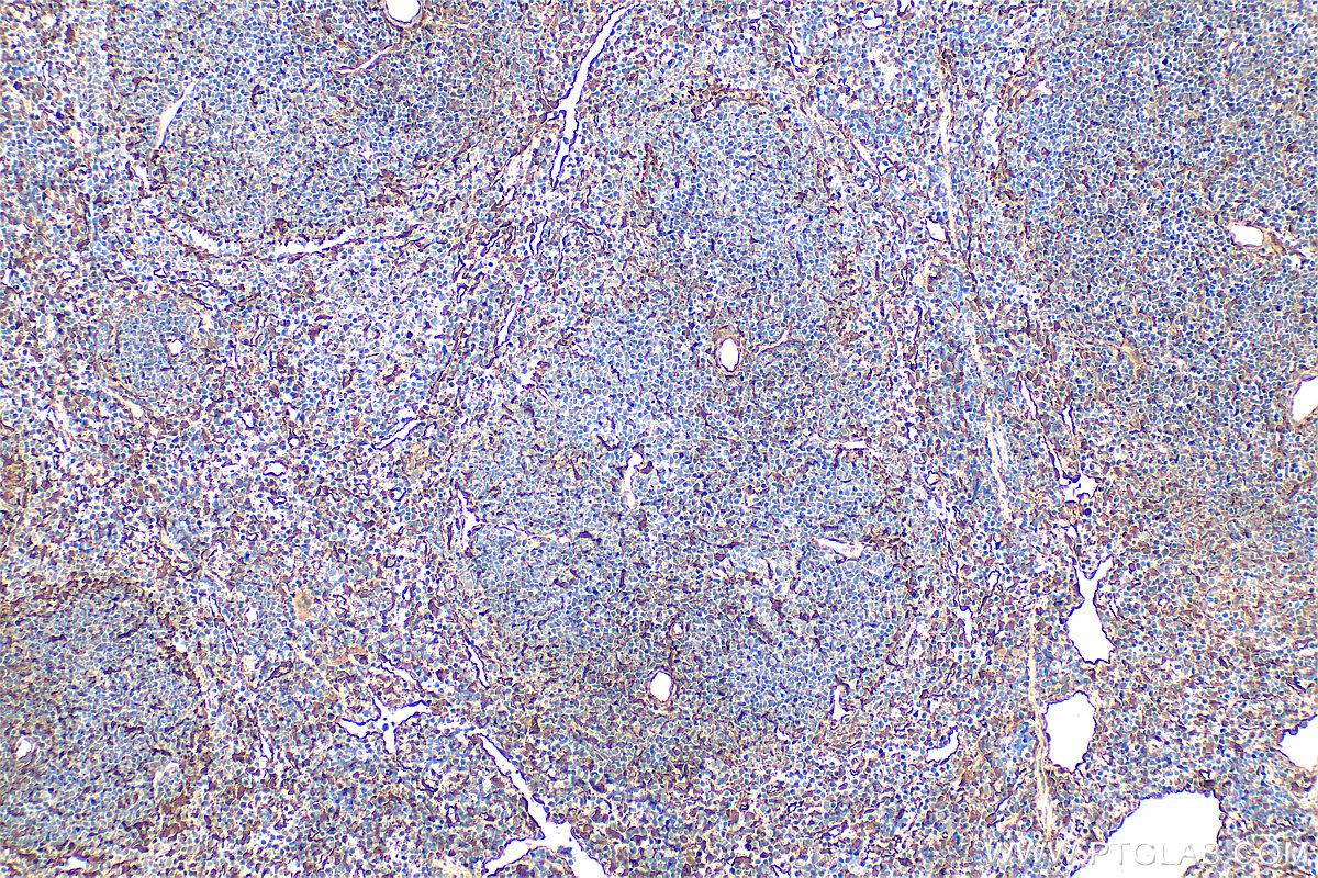 IHC staining of mouse spleen using 11060-1-AP