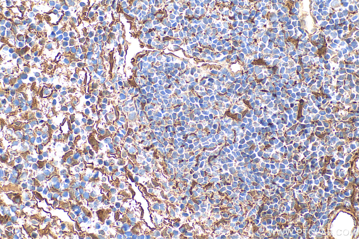 IHC staining of mouse spleen using 11060-1-AP