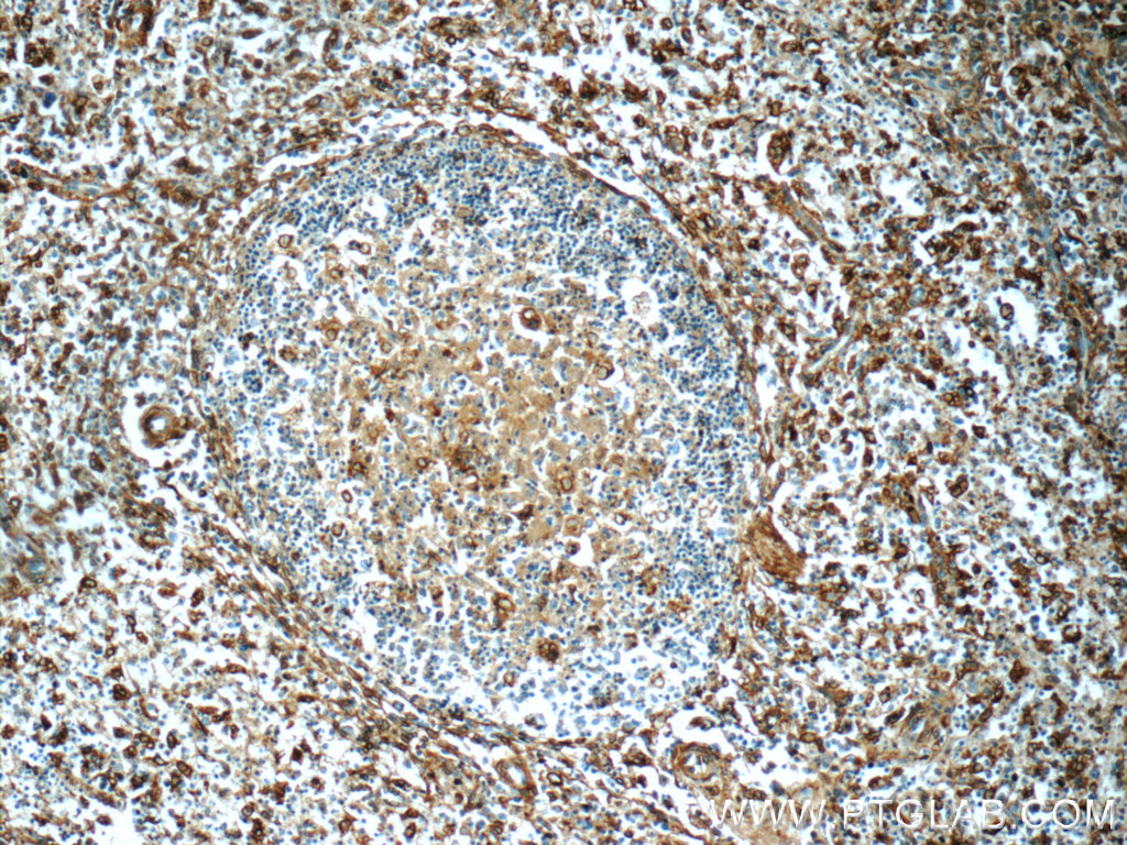 IHC staining of human spleen using 11060-1-AP