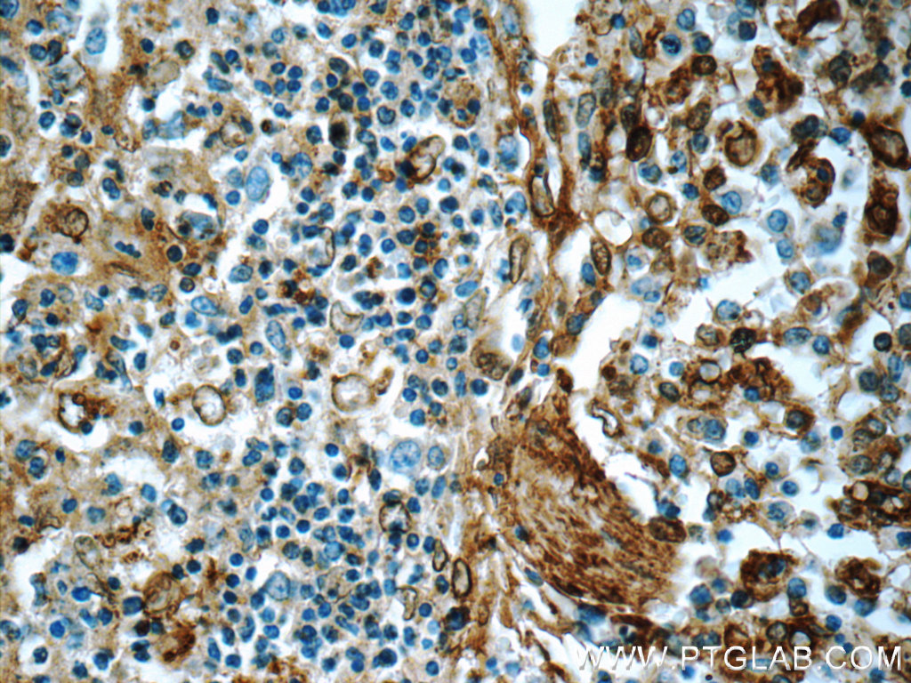 IHC staining of human spleen using 11060-1-AP