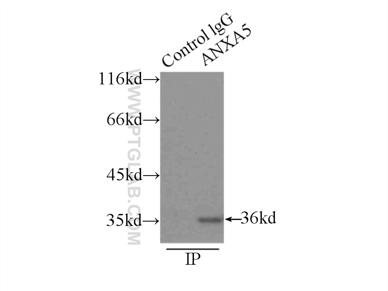 IP experiment of HeLa using 11060-1-AP