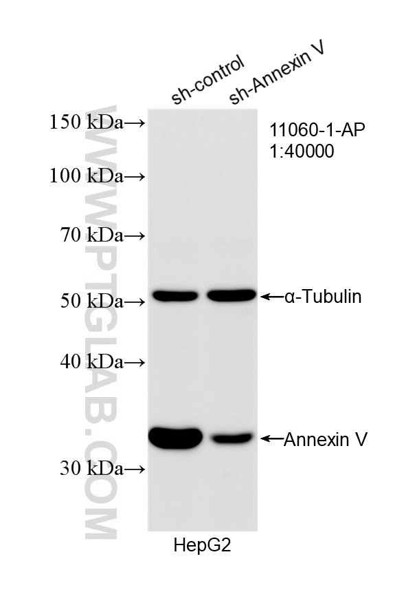 WB analysis of HepG2 using 11060-1-AP
