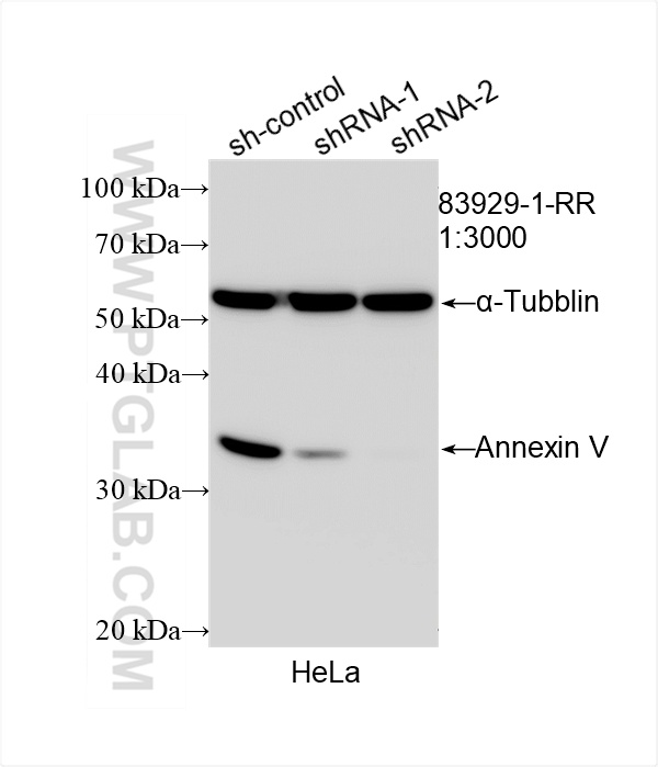 WB analysis of HeLa using 83929-1-RR (same clone as 83929-1-PBS)