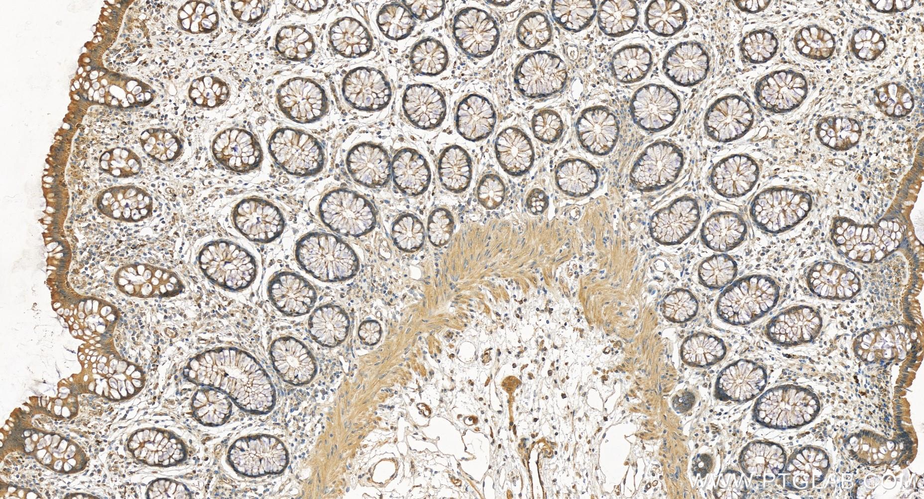 IHC staining of human colon using 83929-2-RR