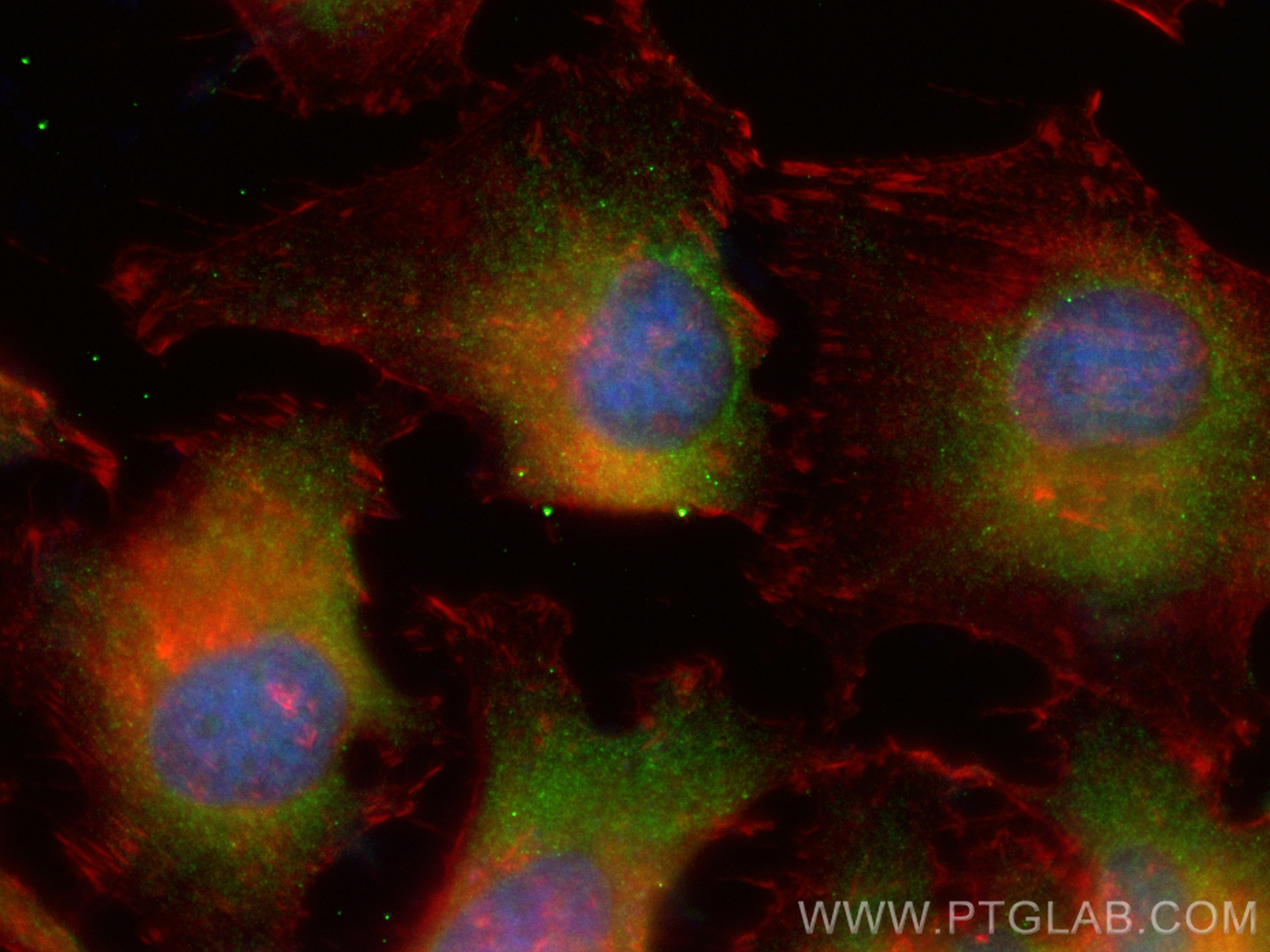 IF Staining of HeLa using CL488-83929-2