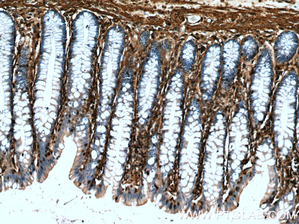 IHC staining of human colon using 12542-1-AP