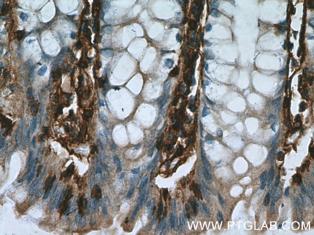 IHC staining of human colon using 12542-1-AP