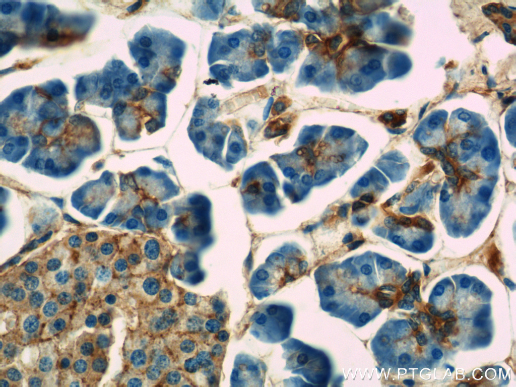 IHC staining of human pancreas using 10154-2-AP