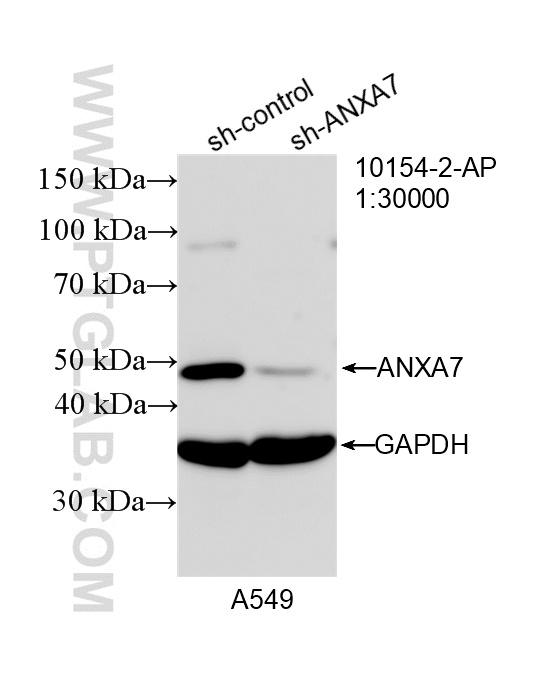 WB analysis of A549 using 10154-2-AP (same clone as 10154-2-PBS)