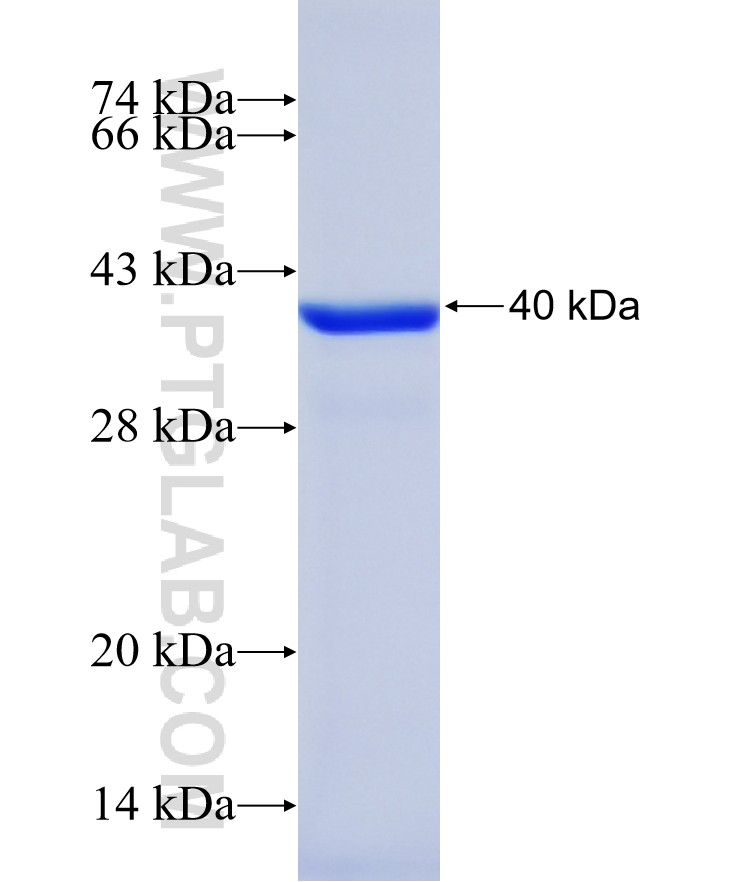 ANXA8 fusion protein Ag39741 SDS-PAGE
