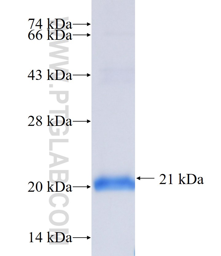 ANXA8 fusion protein Ag39752 SDS-PAGE ANXA8 fusion protein Ag39752 SDS-PAGE
