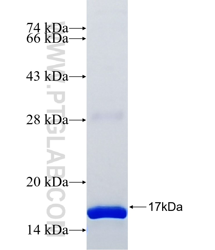 ANXA8L1 fusion protein Ag37919 SDS-PAGE ANXA8L1 fusion protein Ag37919 SDS-PAGE