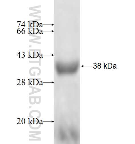 ANXA9 fusion protein Ag7942 SDS-PAGE ANXA9 fusion protein Ag7942 SDS-PAGE