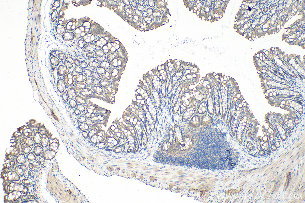 IHC staining of mouse colon using 12911-1-AP