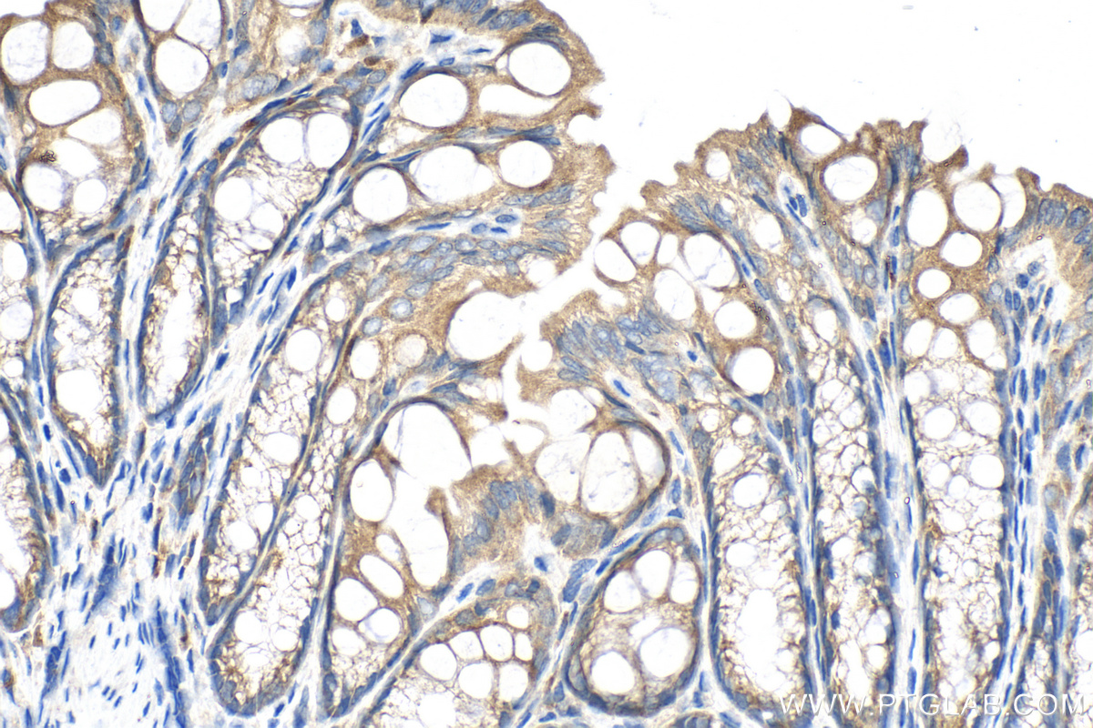 IHC staining of mouse colon using 12911-1-AP