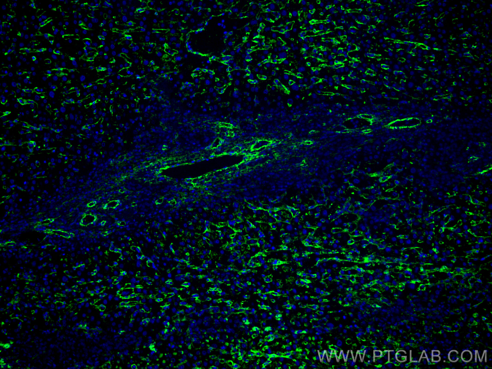 IF Staining of human liver cancer using CL488-66834