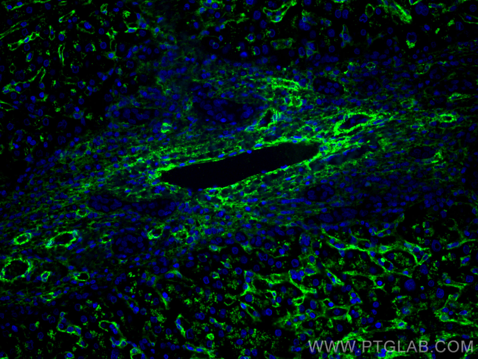 IF Staining of human liver cancer using CL488-66834