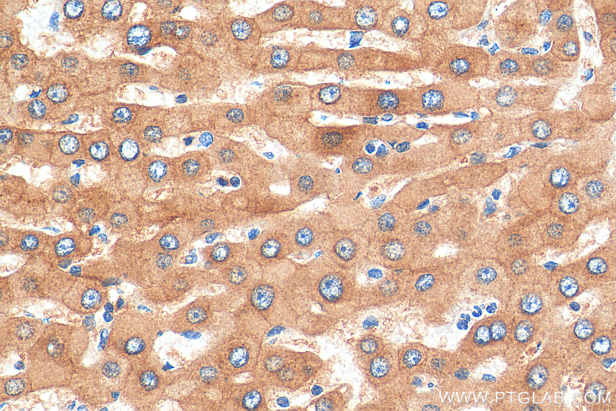 IHC staining of human hepatocirrhosis using 19495-1-AP