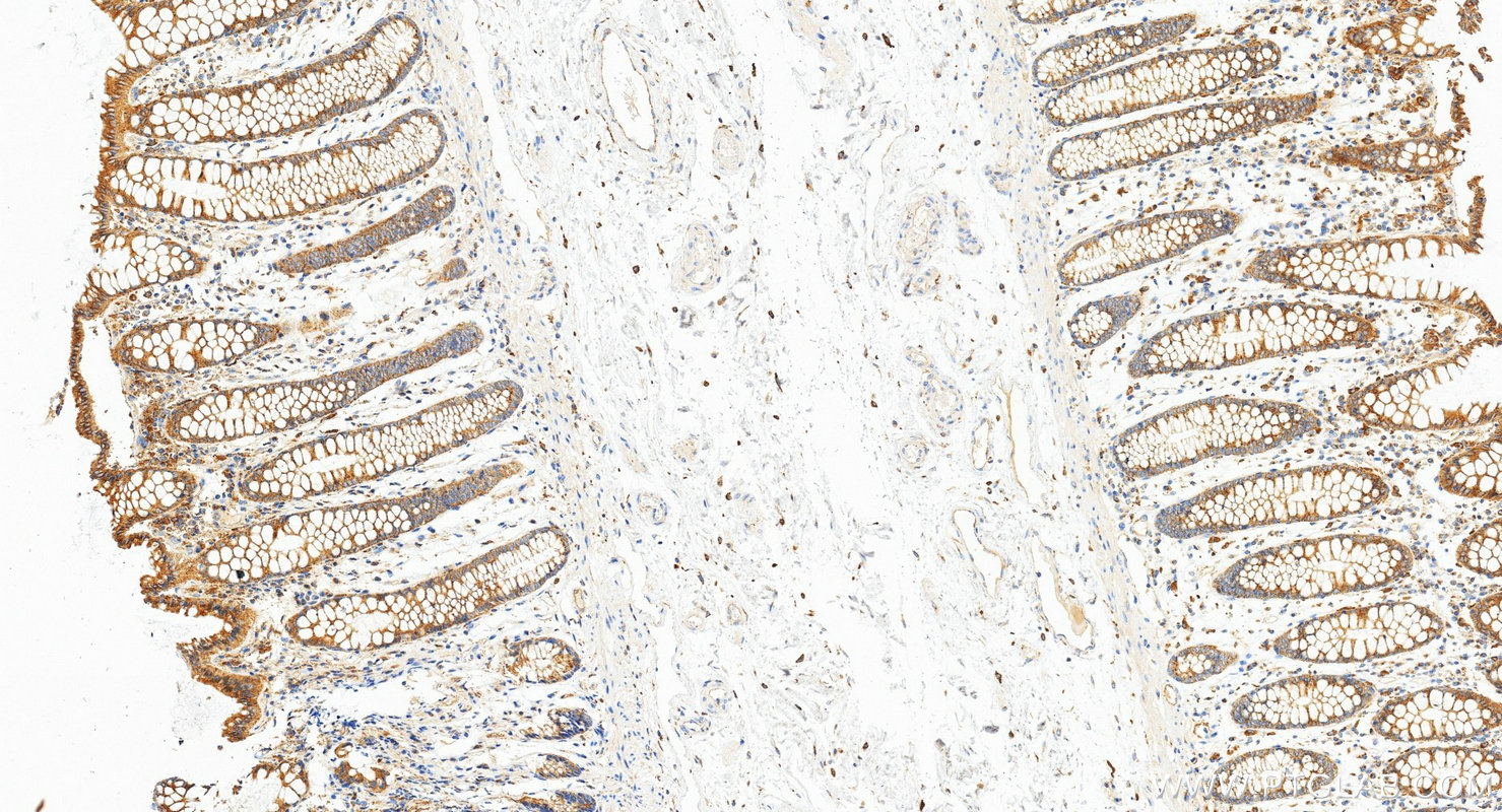 IHC staining of human colon using 87859-1-RR (same clone as 87859-1-PBS) IHC staining of human colon using 87859-1-RR (same clone as 87859-1-PBS)
