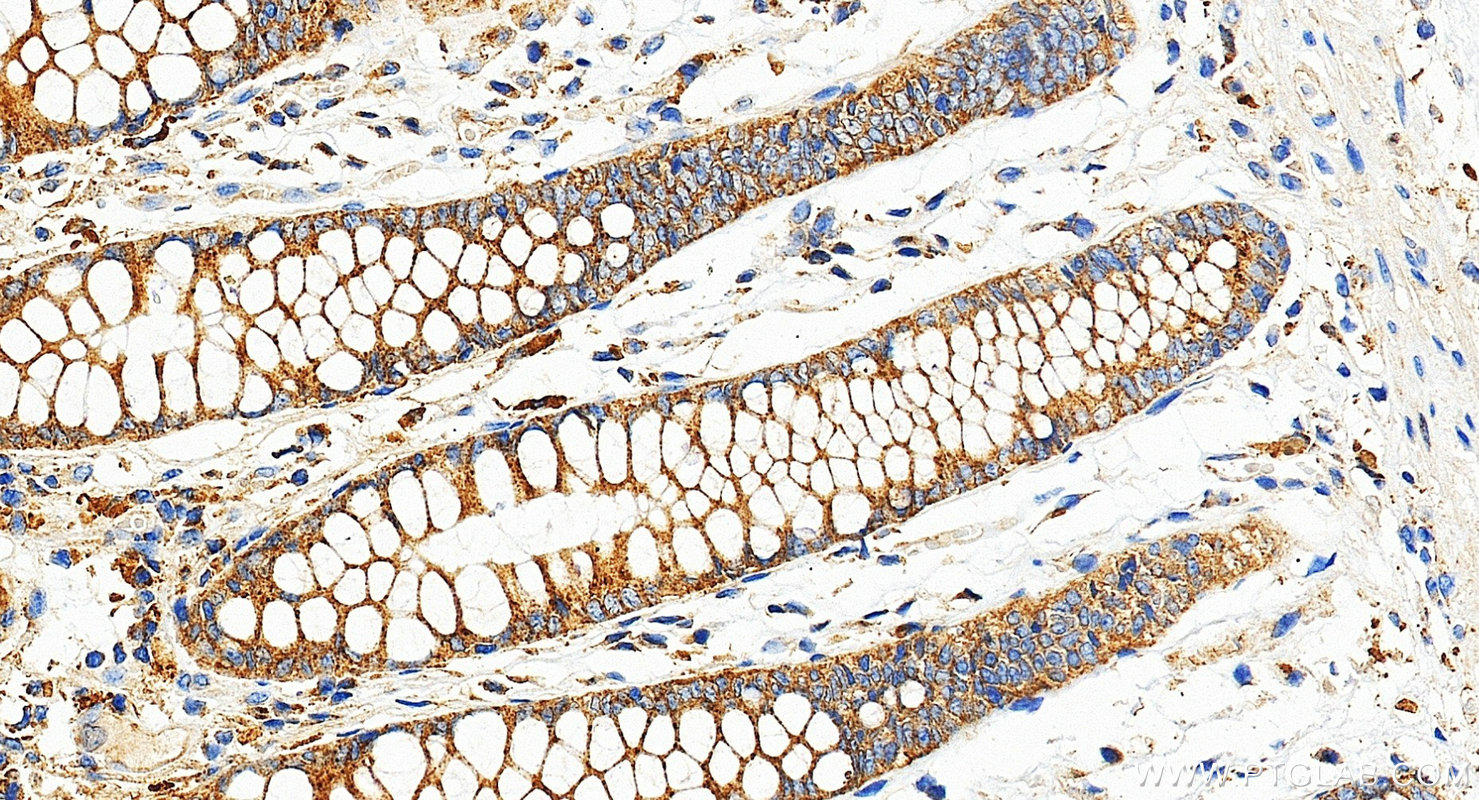 IHC staining of human colon using 87859-1-RR (same clone as 87859-1-PBS) IHC staining of human colon using 87859-1-RR (same clone as 87859-1-PBS)