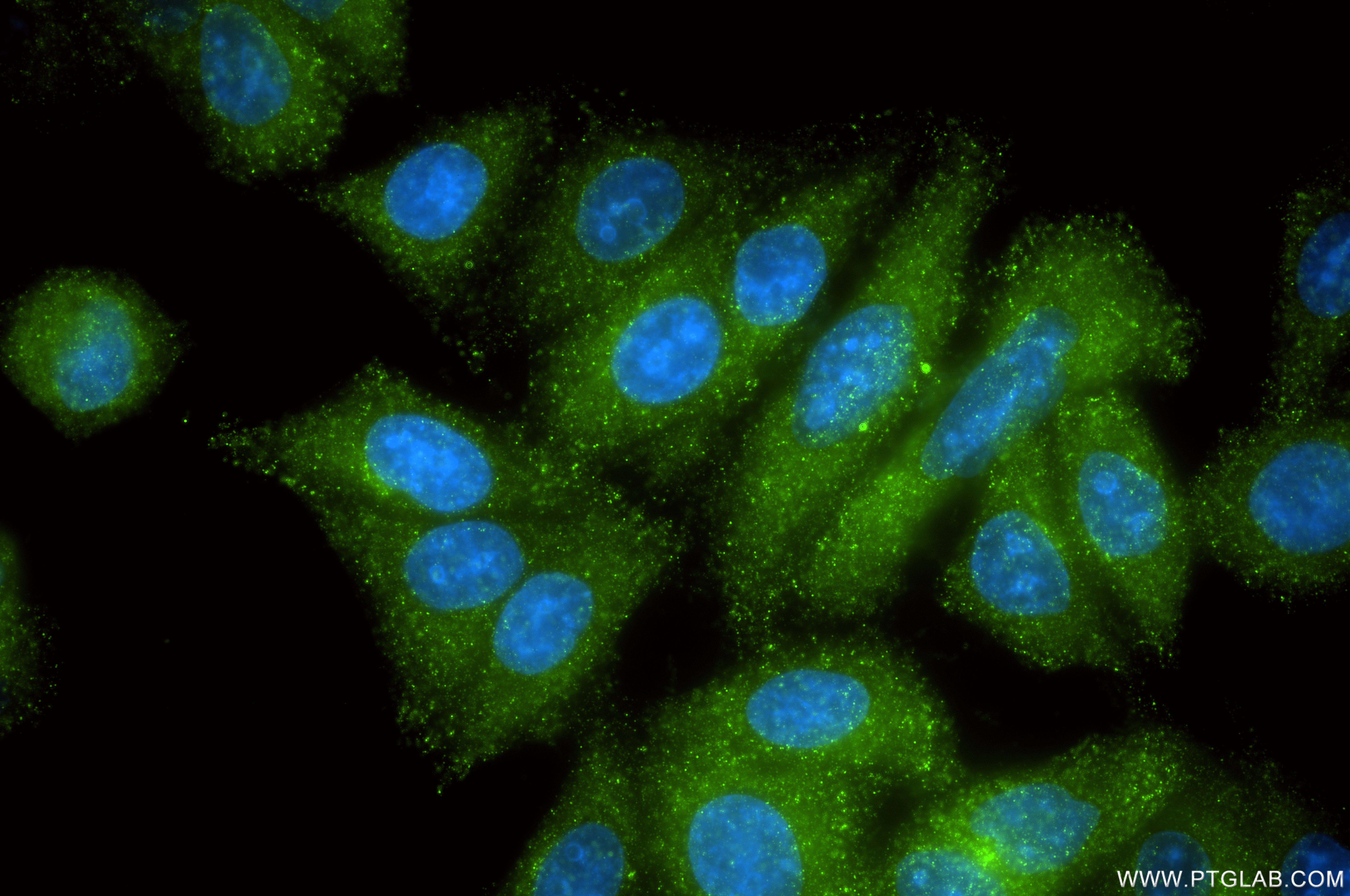 IF Staining of HepG2 using 87859-1-RR (same clone as 87859-1-PBS) IF Staining of HepG2 using 87859-1-RR (same clone as 87859-1-PBS)